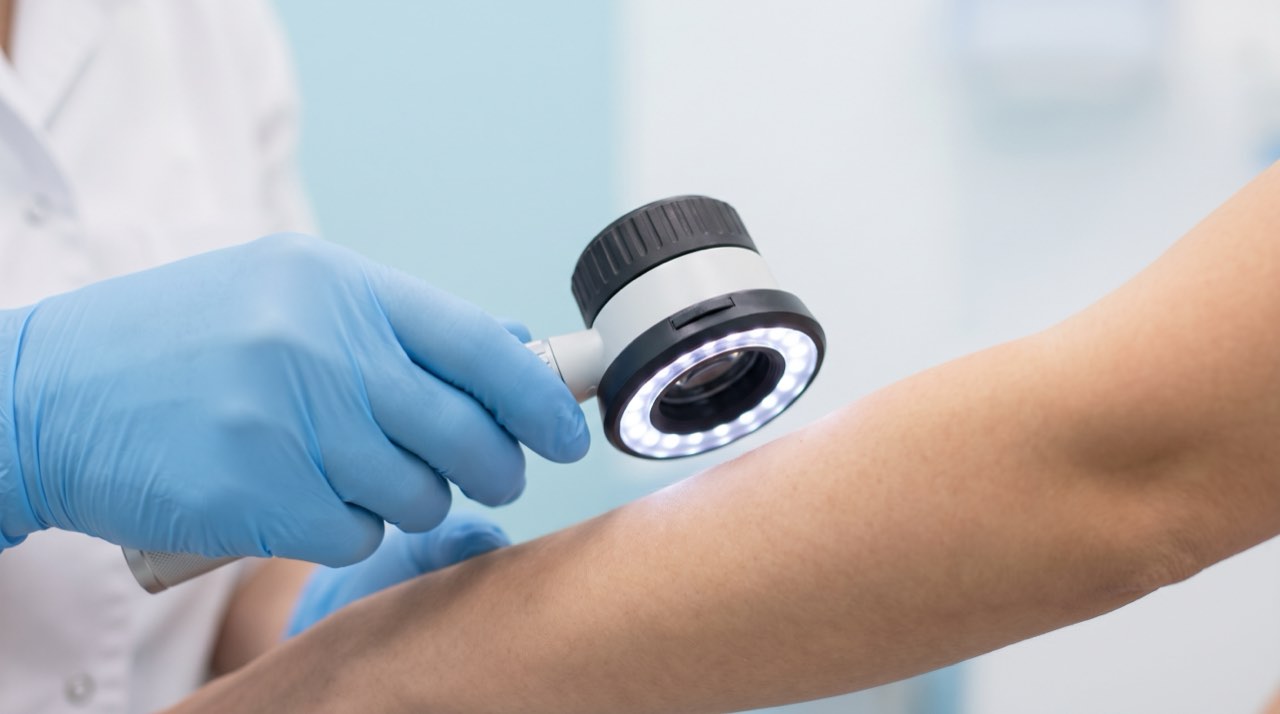 A dermatologist examining a patient’s forearm with a dermatoscope