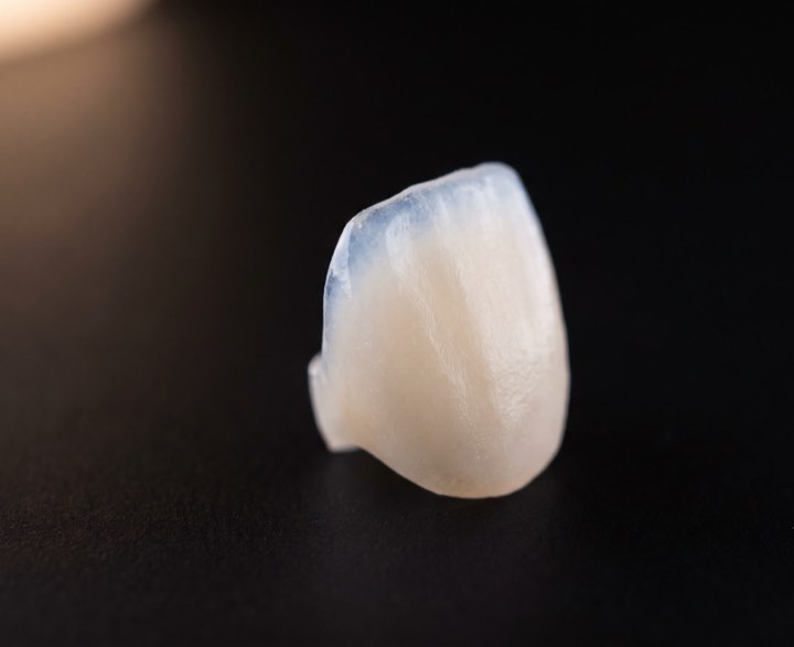 A single porcelain veneer held up to the light