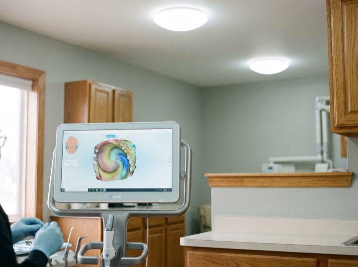 A digital smile preview on a chairside screen