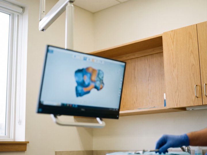 A digital smile preview shown chairside