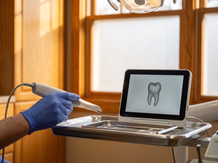 Intraoral scanner in the treatment room