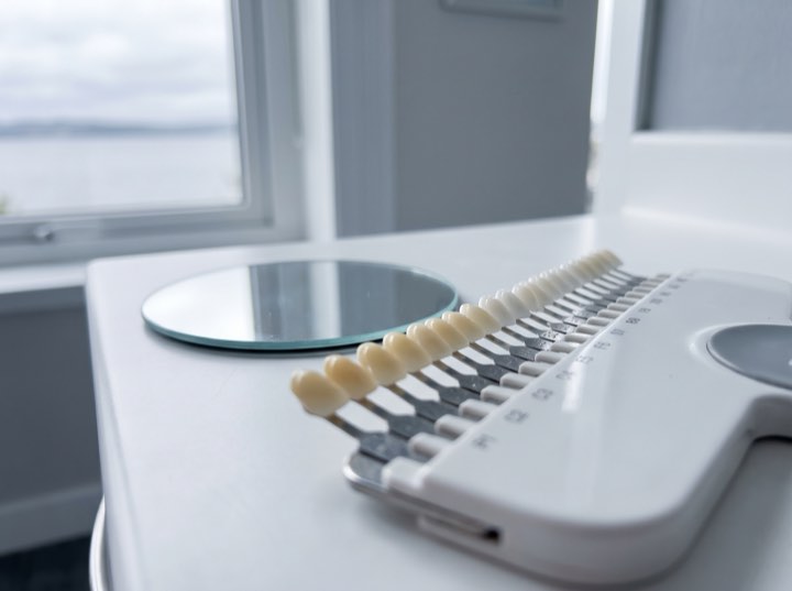 Shade guide held against teeth