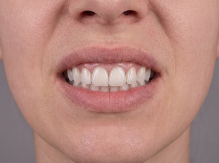 The same smile after treatment