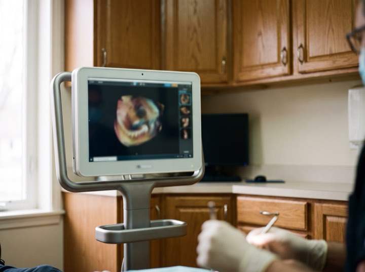 A digital smile preview shown chairside