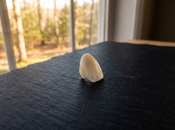 A single porcelain veneer on slate in window light