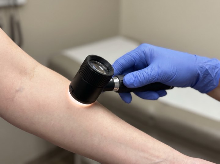 Dermatoscope against a patient's arm