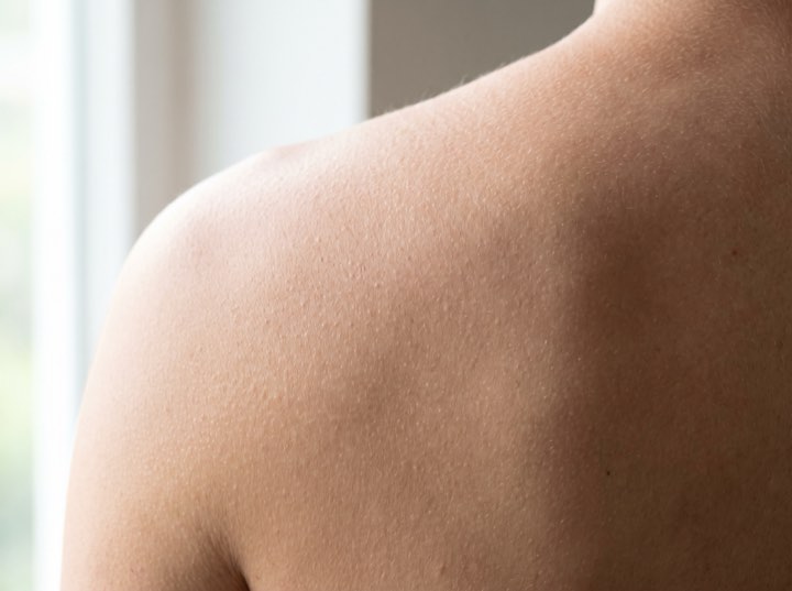 Skin in daylight, close up