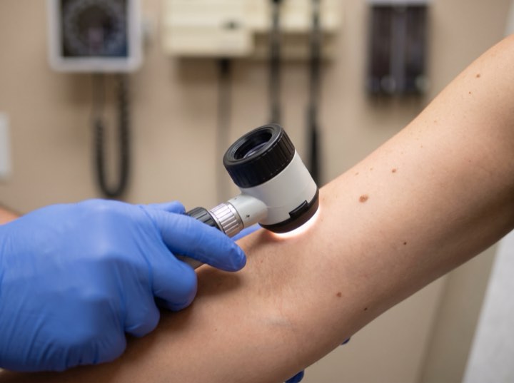 A gloved hand holding a dermatoscope to a patient’s forearm