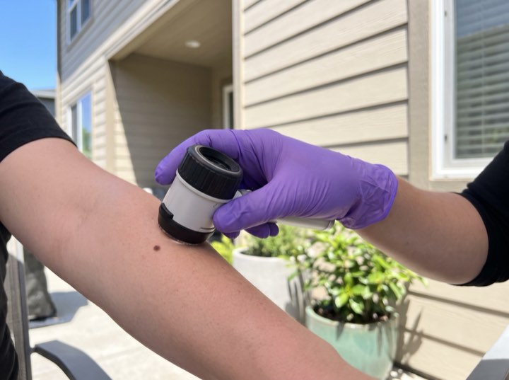 The dermatoscope, every check