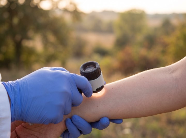 The dermatoscope, every check